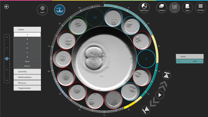 Annotation of different Morphokinetic Variables Using the Miri TL