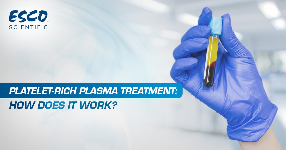 How Platelet-Rich Plasma Treatment Work | Esco Scientific How Platelet-Rich Plasma Treatment Work | Esco Scientific
