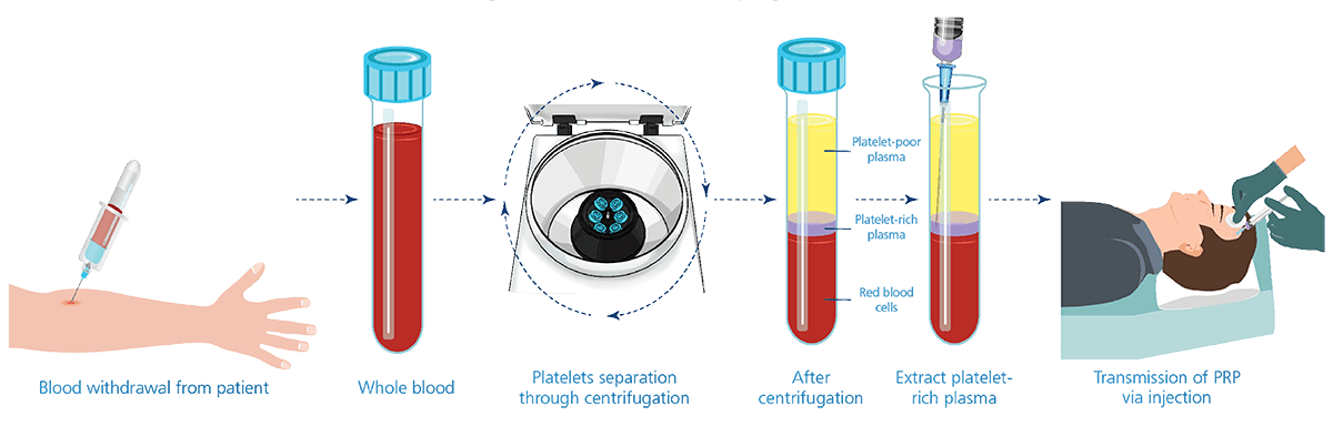 Blood plasma: what it is and how it works