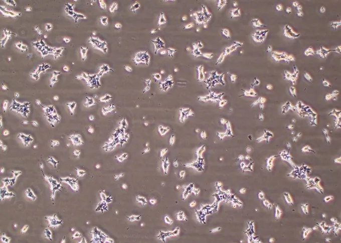 Microscopic view of Passage 5 cells at Day 2 (left)