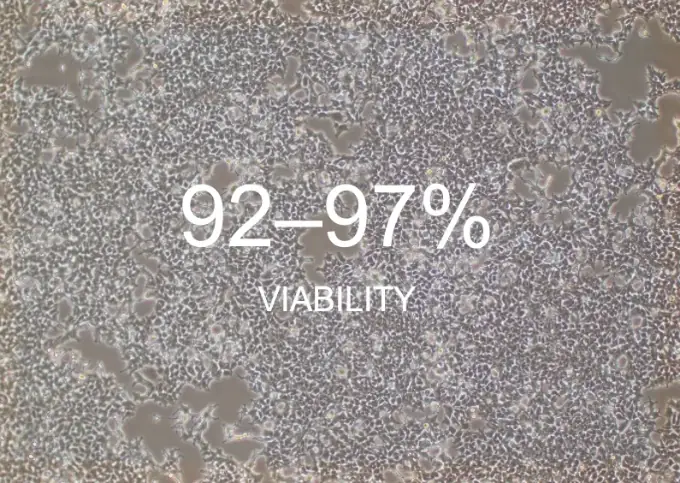 Microscopic view of Passage 5 cells at Day 5 (right) with viability percentage